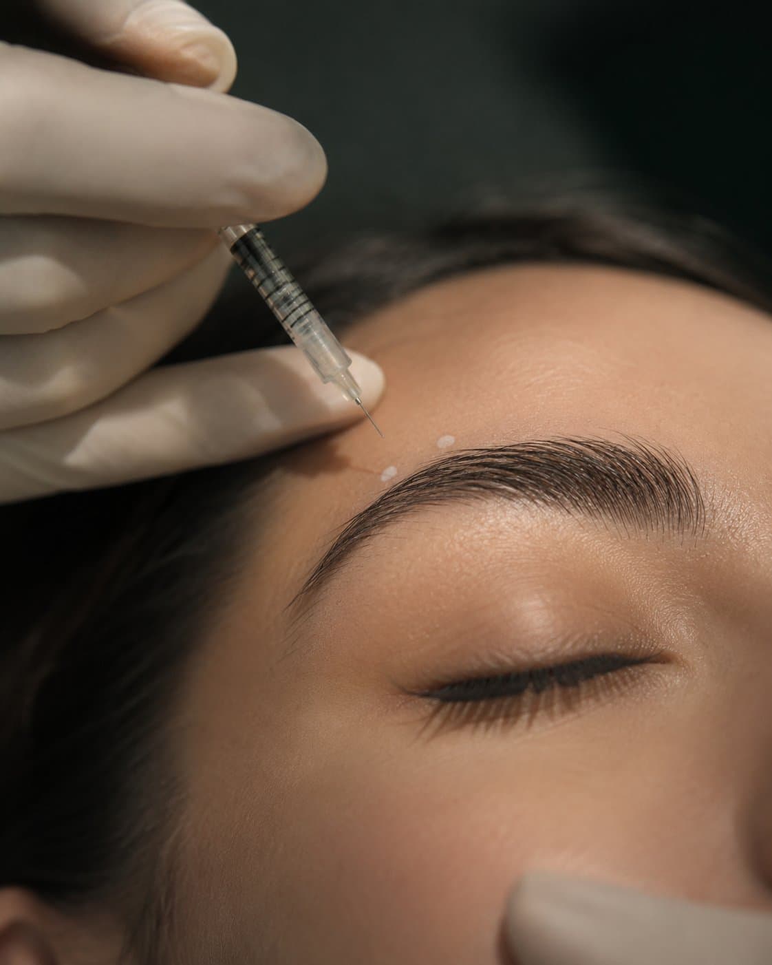 A practitioner steadying a fine needle above a client's brow