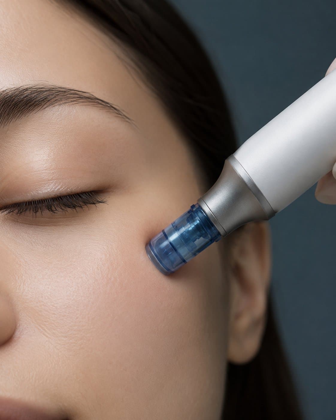 Microneedling, editorial image