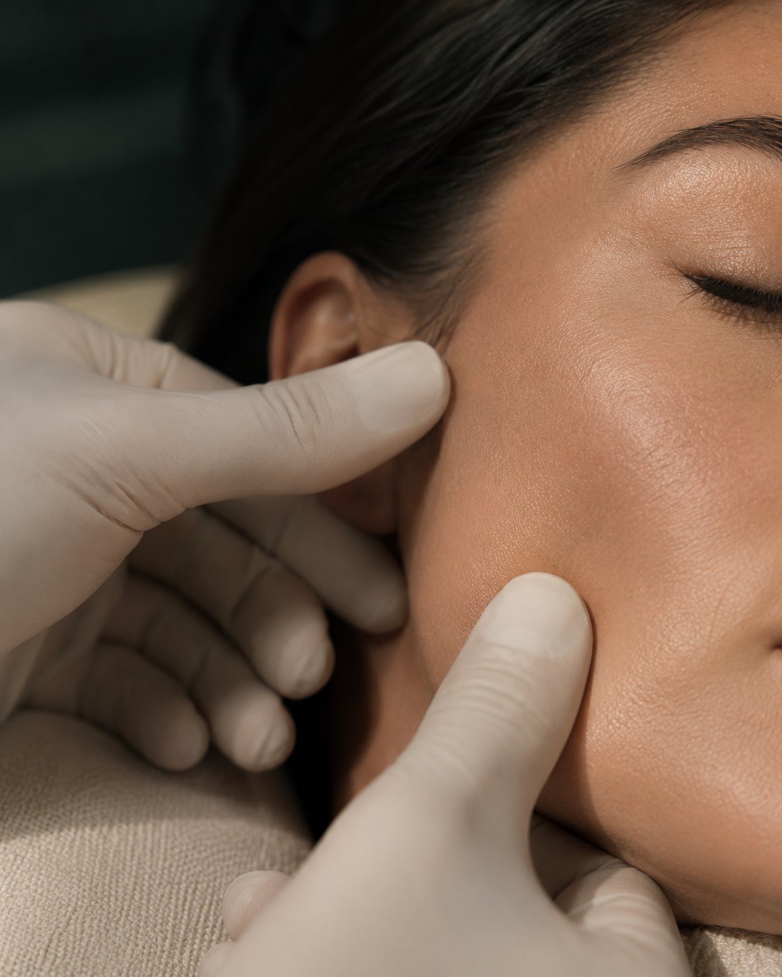 Dermal fillers